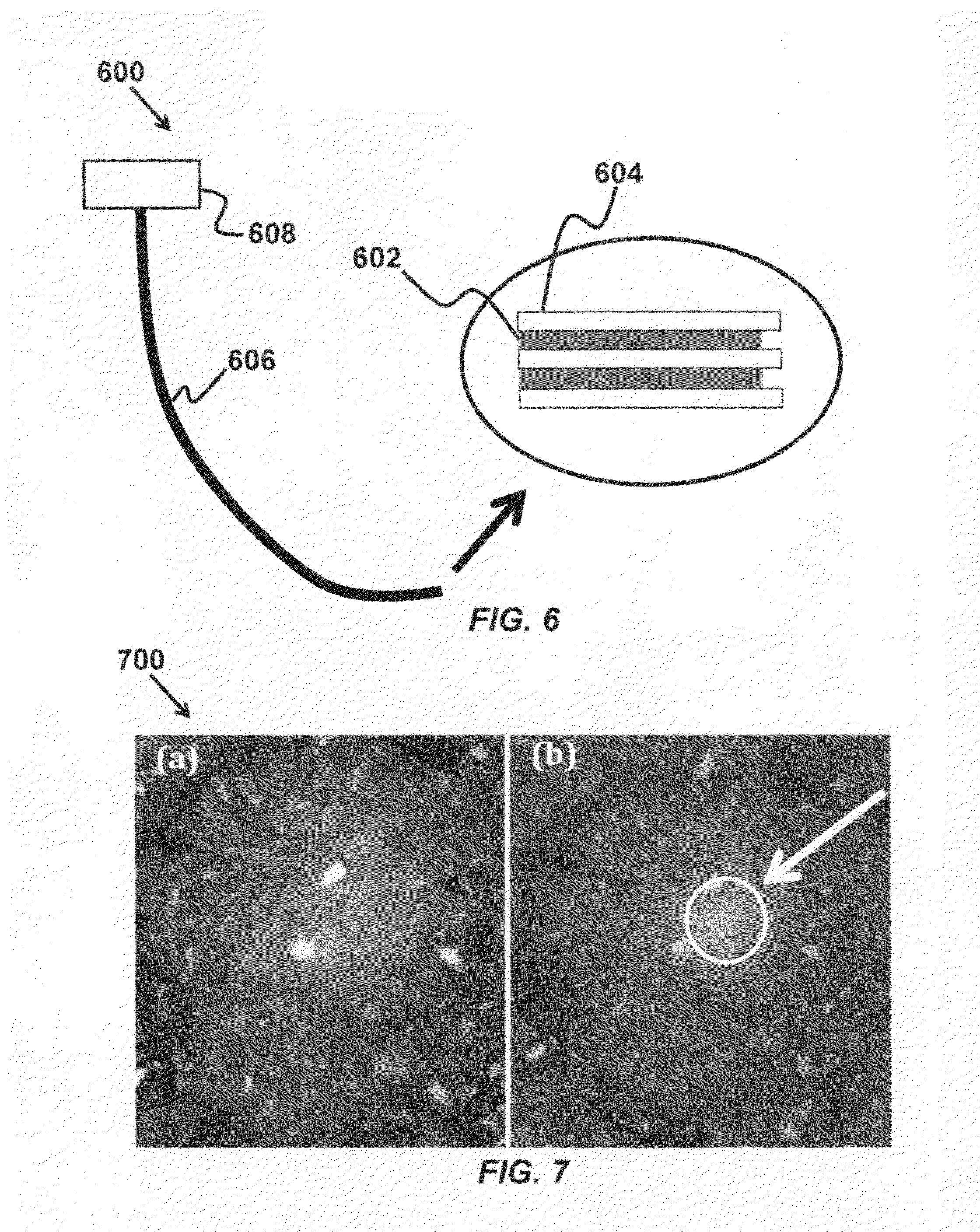 Method for tissue characterization based on beta radiation and coincident Cherenkov radiation of a radiotracer