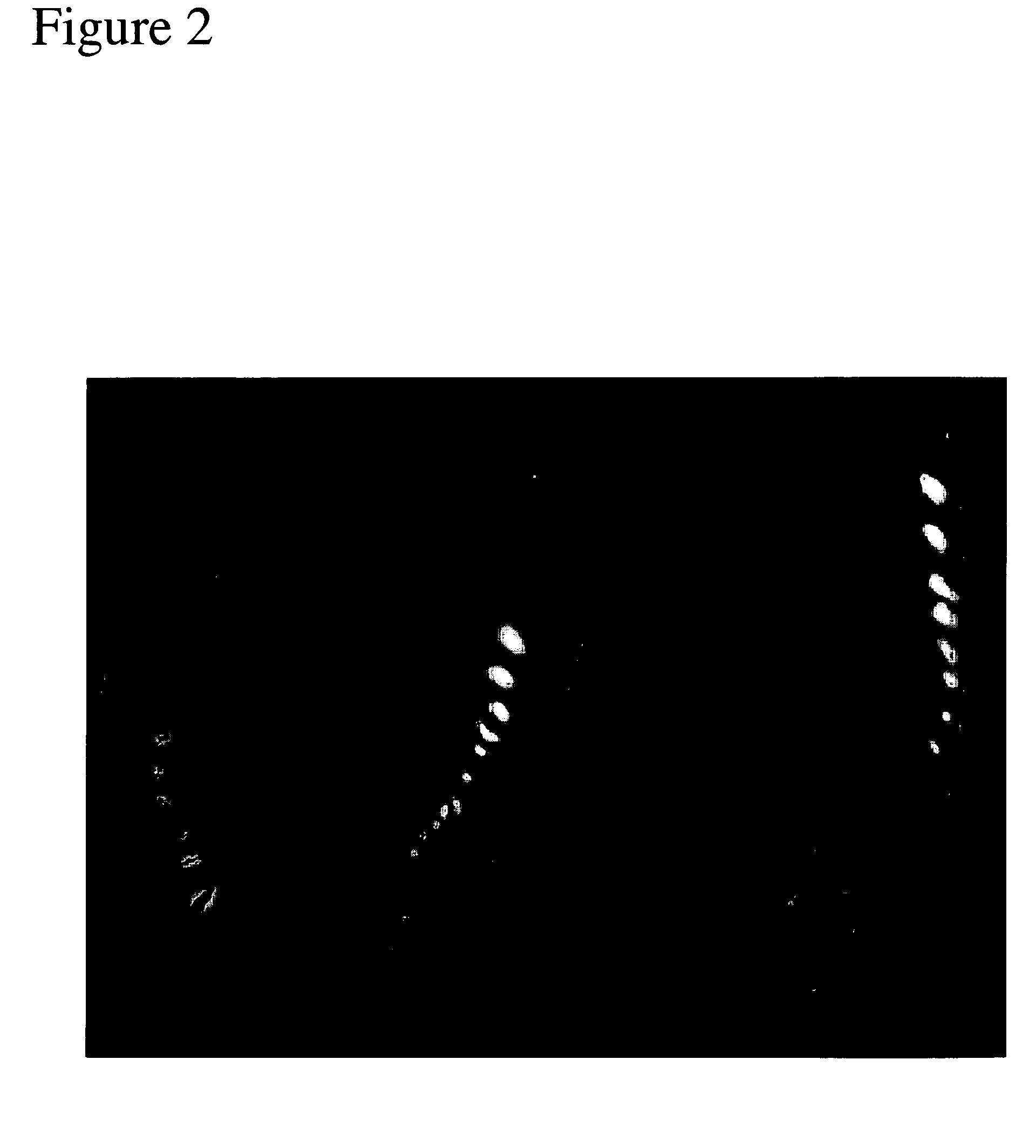 Quantification method of vessel calcification