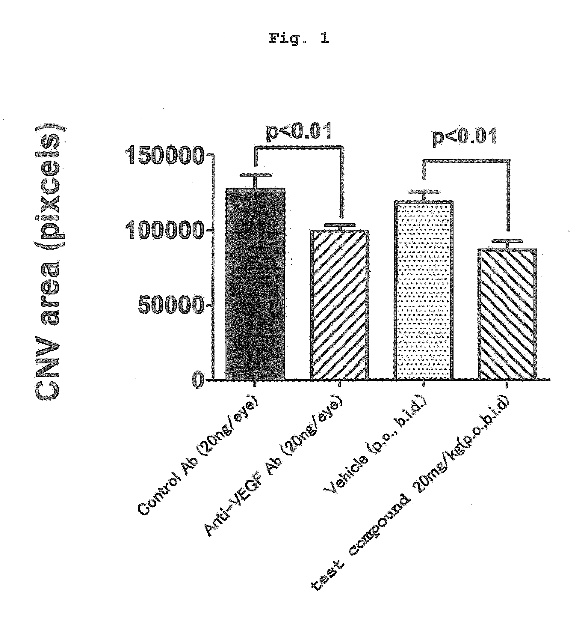 Therapeutic agent for ophthalmic disease