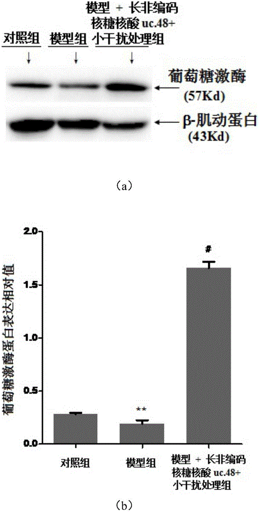 Application of long non-coding RNA uc.48+ small interfering RNA to preparation of medicine for treating DM and complications