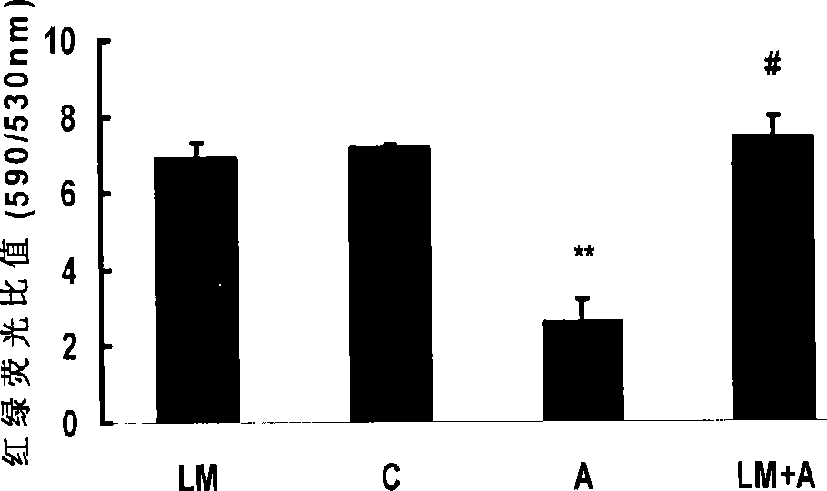 Use of lipoamide for preventing and treating age related macular degeneration