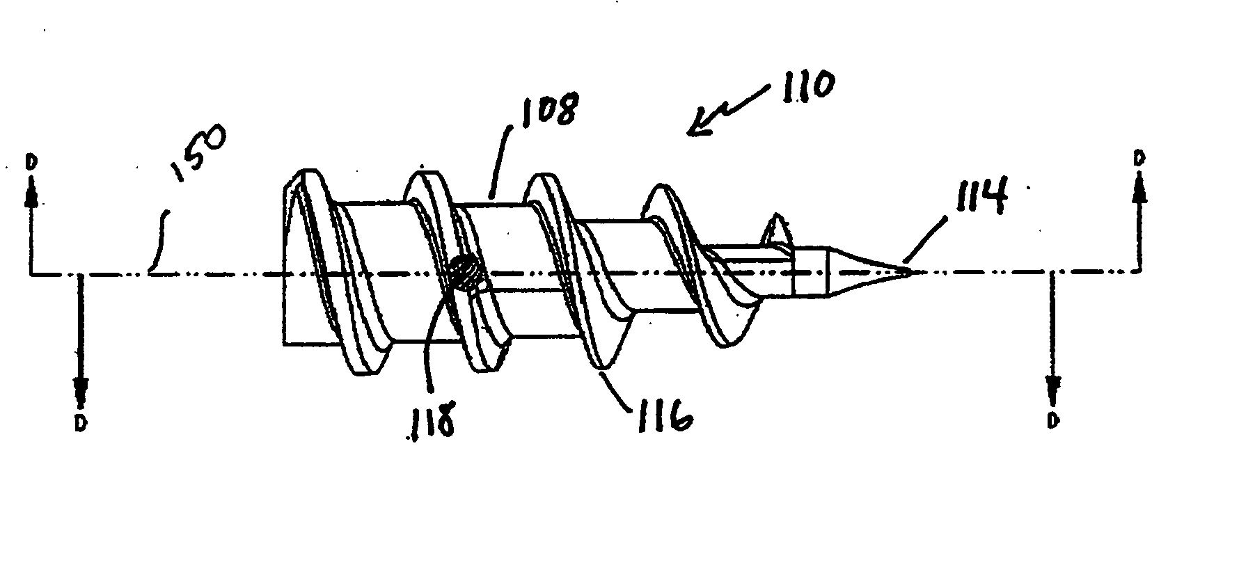 Fully threaded suture anchor with transverse anchor pin