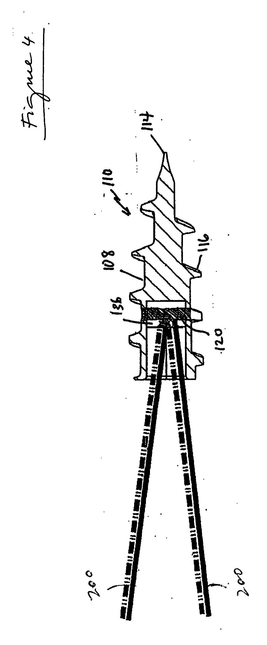 Fully threaded suture anchor with transverse anchor pin