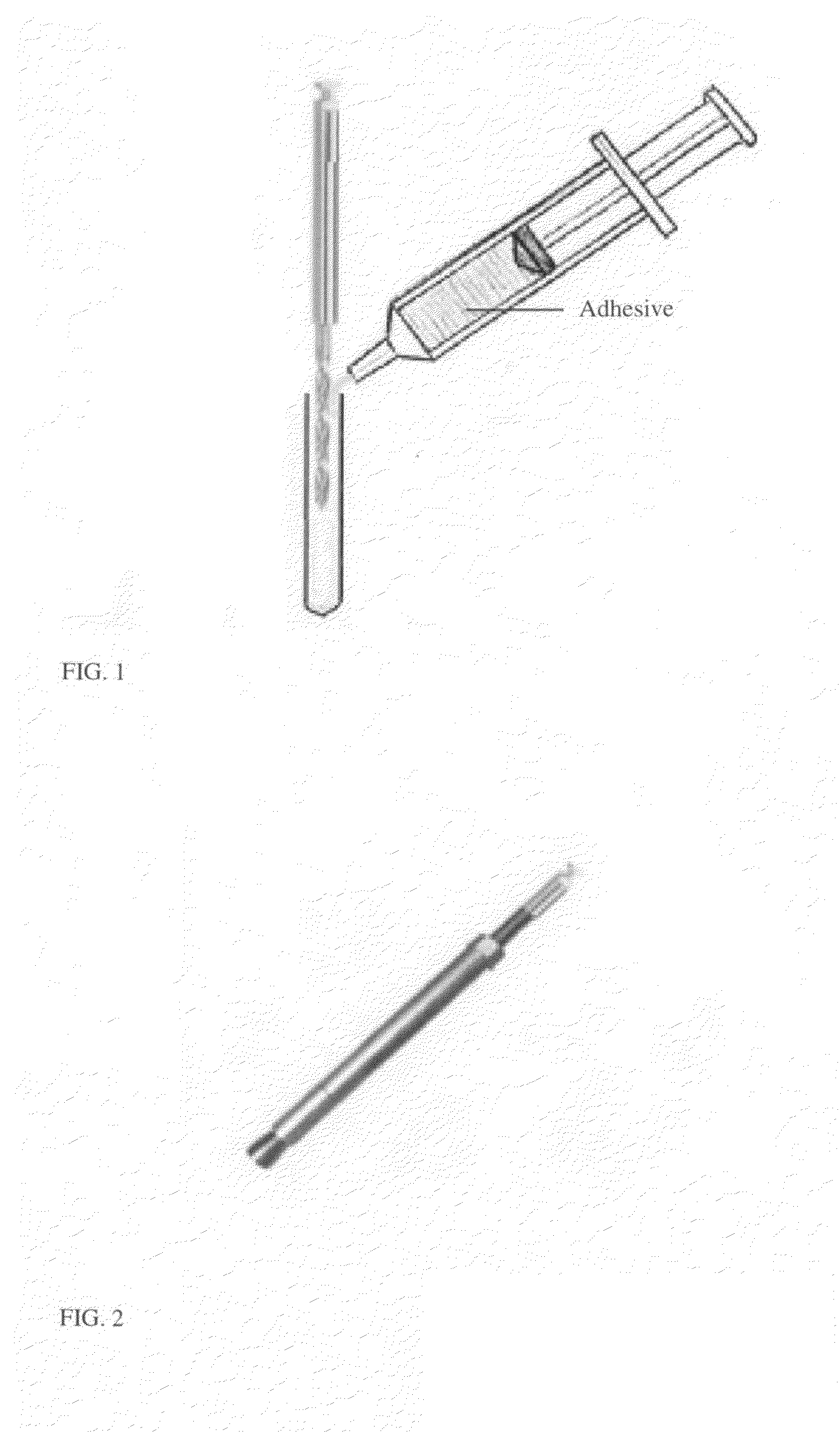 Dental Extraction Burs for Extraction of a tooth or a portion of a Tooth