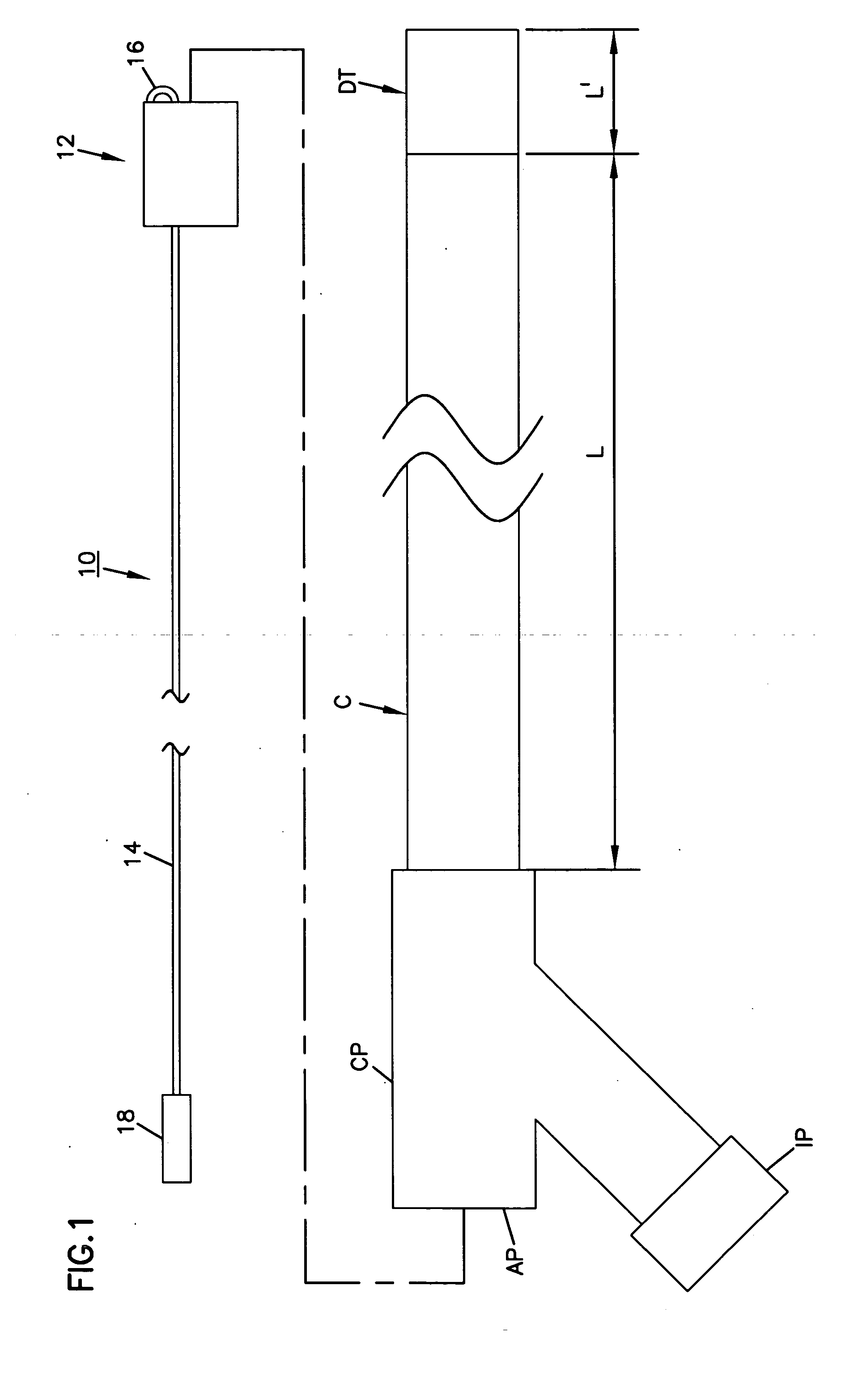 Vascular clip-on occlusion system