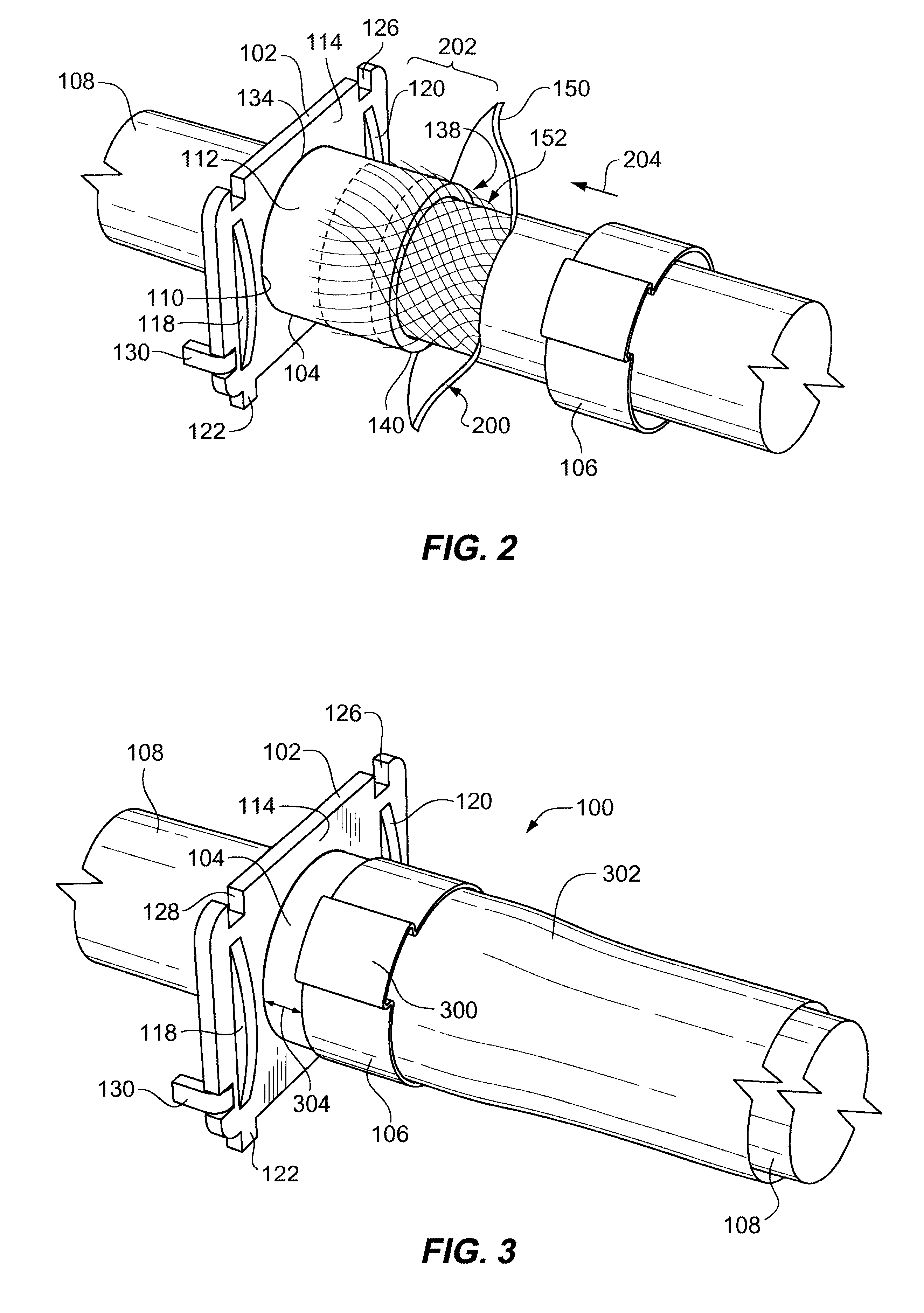 Cable retention system