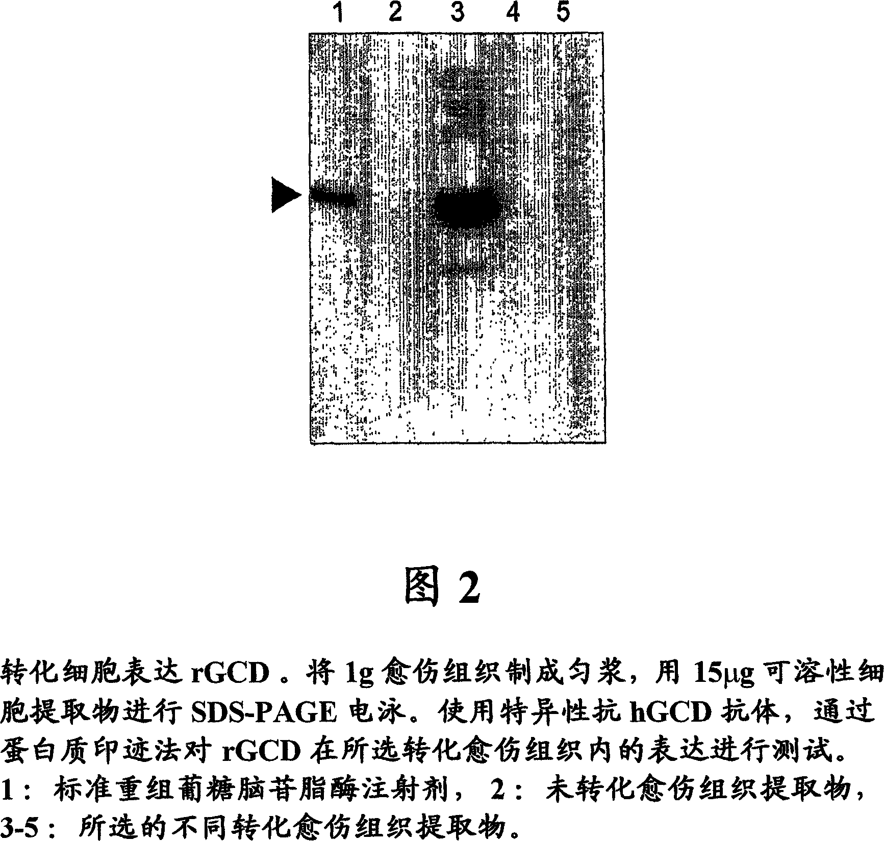 Production of high mannose proteins in plant culture