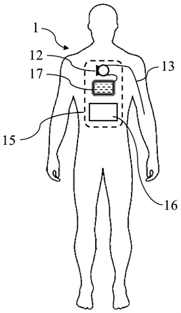 Hemostasis training system and simulated human body model for battlefield rescue training