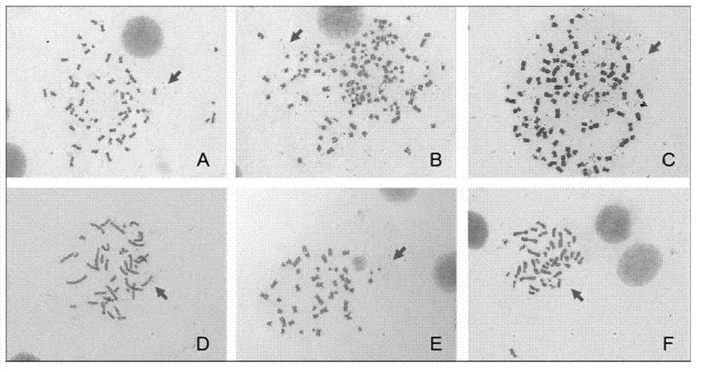 Application of MAPK-ERK1/2 signal channel inhibitor to preparation of double-minute medicine for removing or inhibiting tumor cells