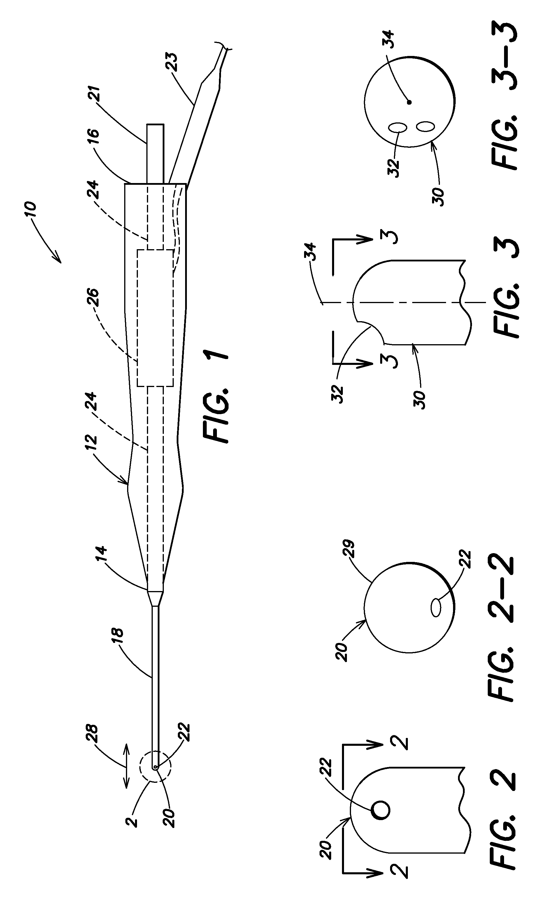 Vibrating surgical device for removal of vitreous and other tissue