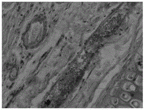 A kind of clarithromycin ion pair liposome injection and preparation method thereof