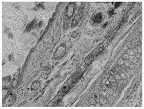 A kind of clarithromycin ion pair liposome injection and preparation method thereof