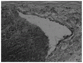 A kind of clarithromycin ion pair liposome injection and preparation method thereof