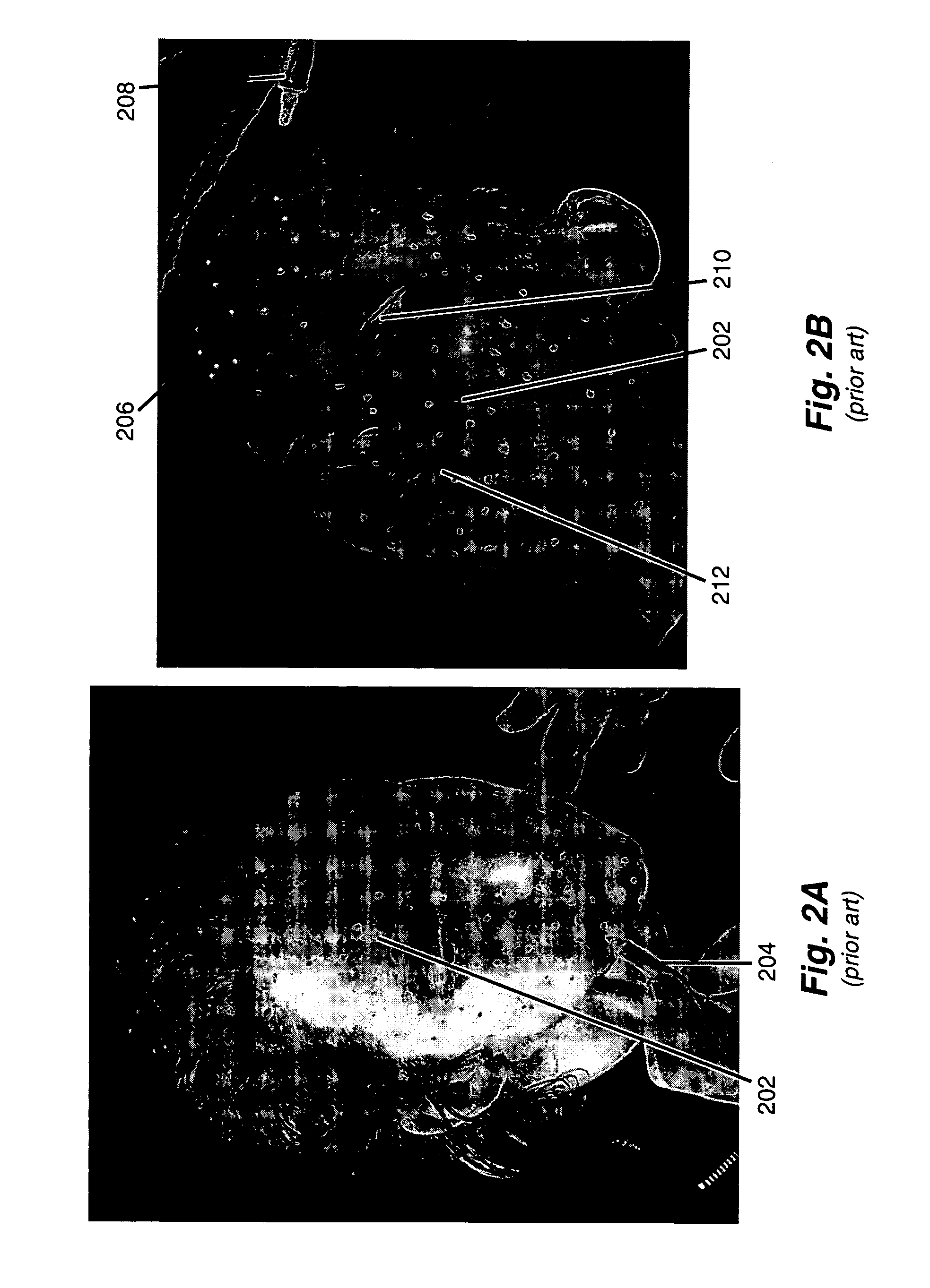 Apparatus and method for performing motion capture using a random pattern on capture surfaces