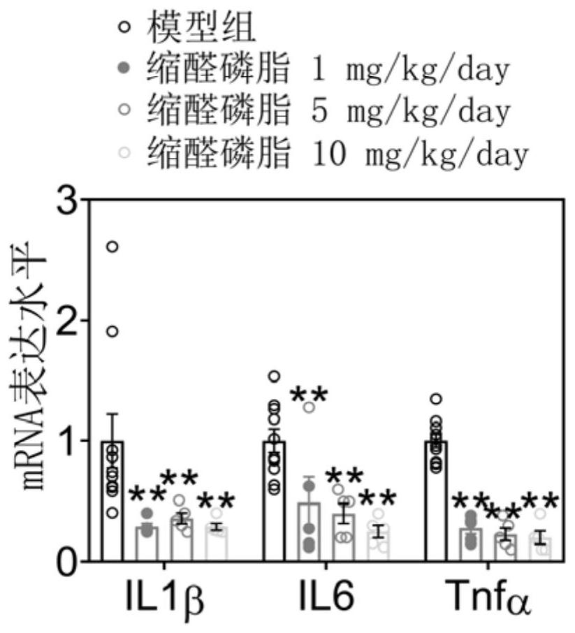 Application of plasmalogen to relieving intestinal inflammations