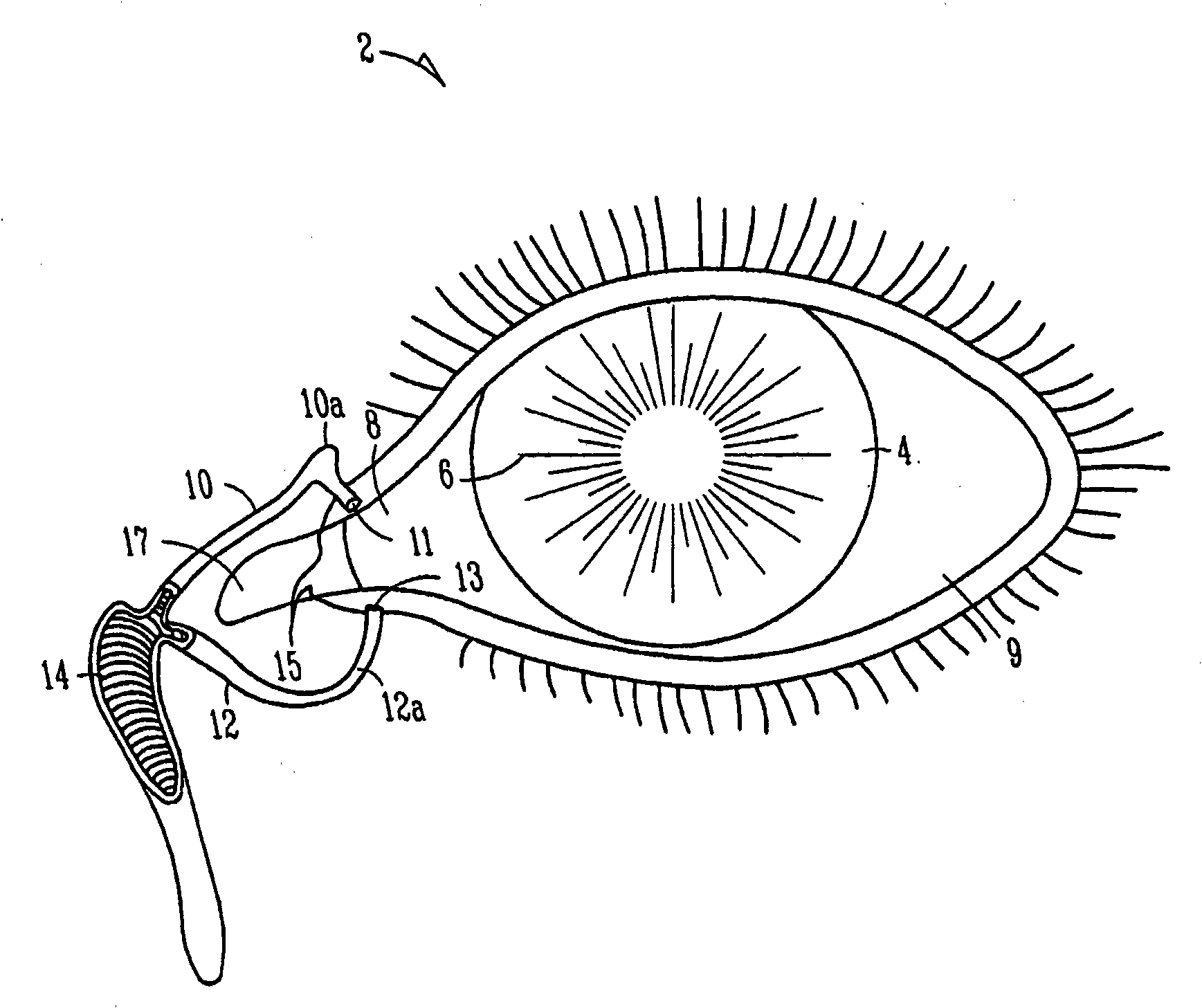 Insertion and extraction tools for lacrimal implants