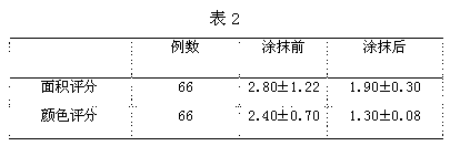 Whitening and moisturizing skin cream and preparation method thereof