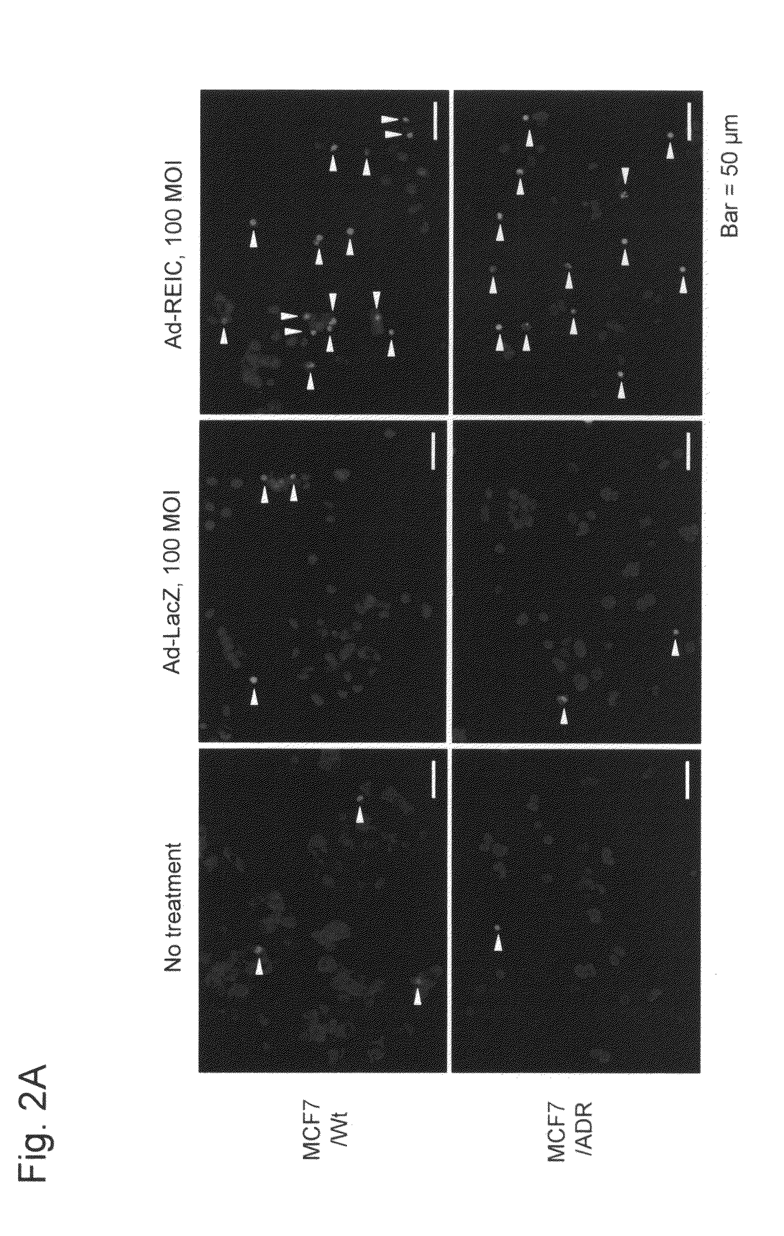 Cancer cell death inducing agent having effects of potentiating anticancer drug against anticancer-drug-resistant cancer