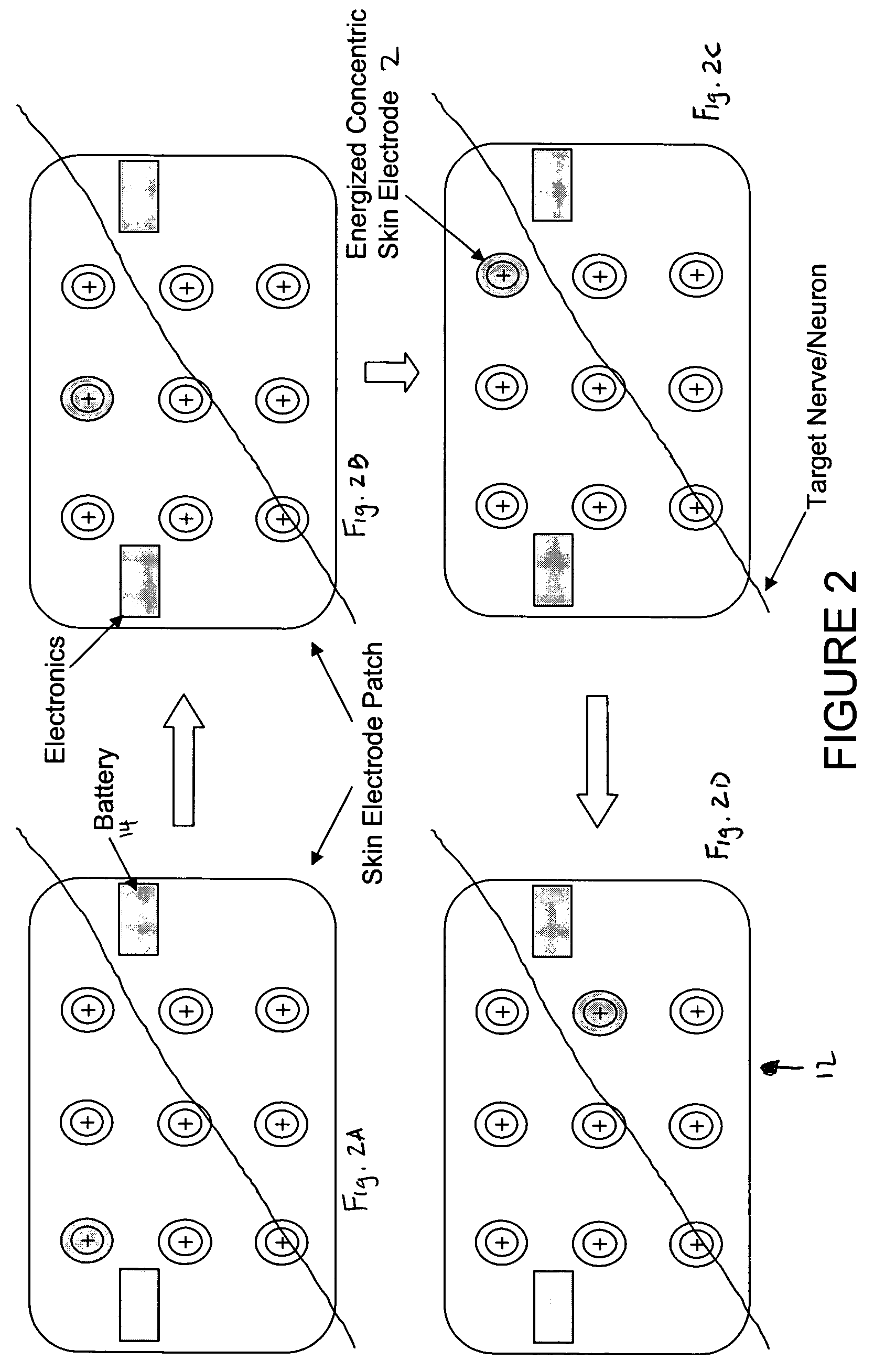 Electrode patch and method for neurostimulation