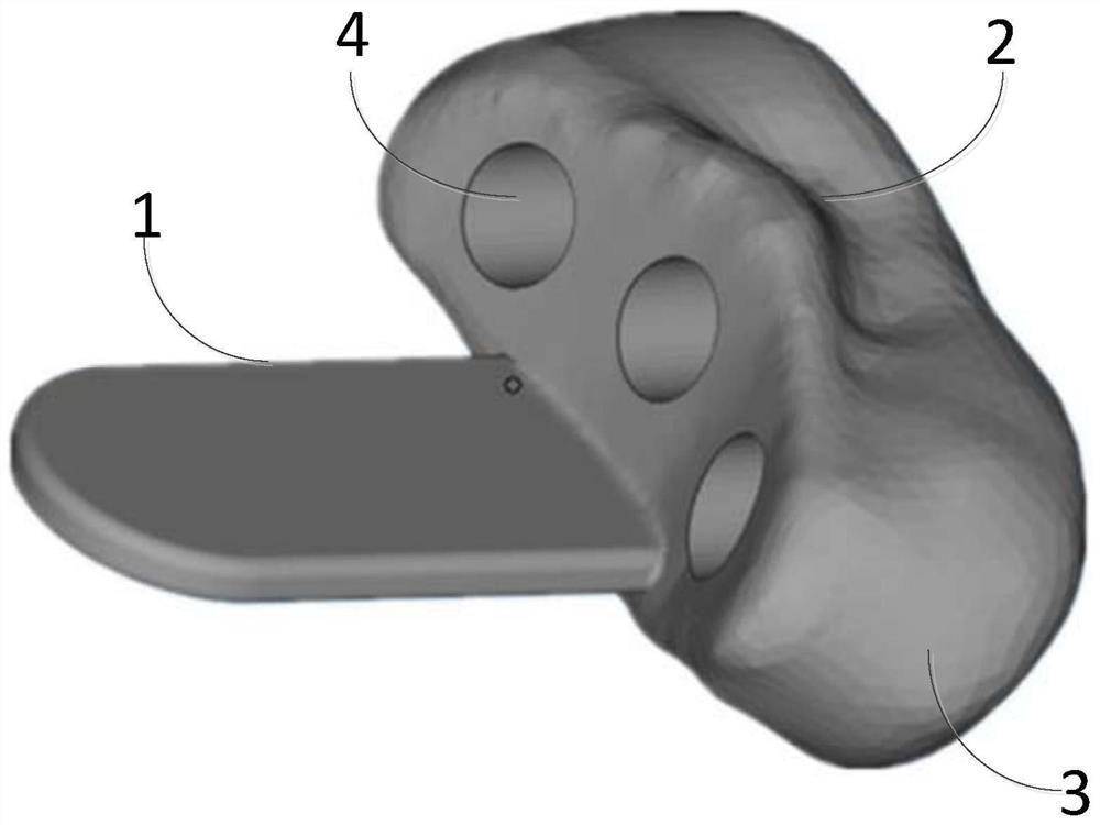 3D printing-based radiotherapy oral cavity stand manufacturing method and device and medium