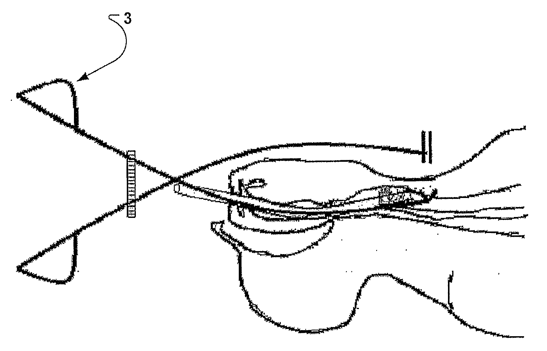 Device and Method for Tracheotomy