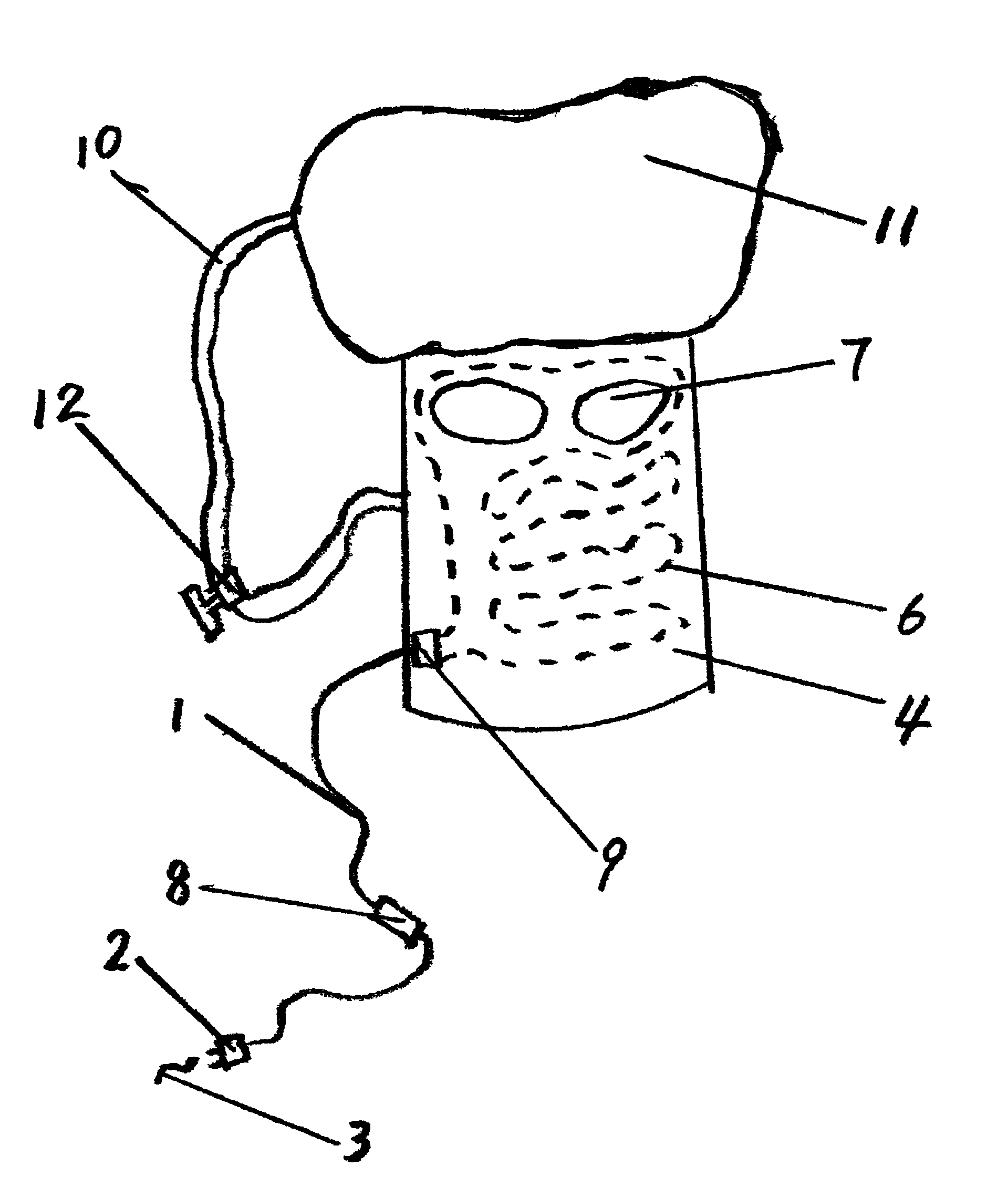 Method for expanding head and respiratory vessels through electrothermal air so as to treat diseases and thermal helmet