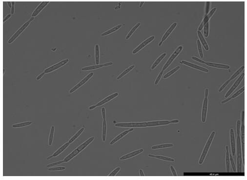 A kind of endogenous strong promoter phsp of smut smut and its expression vector and application