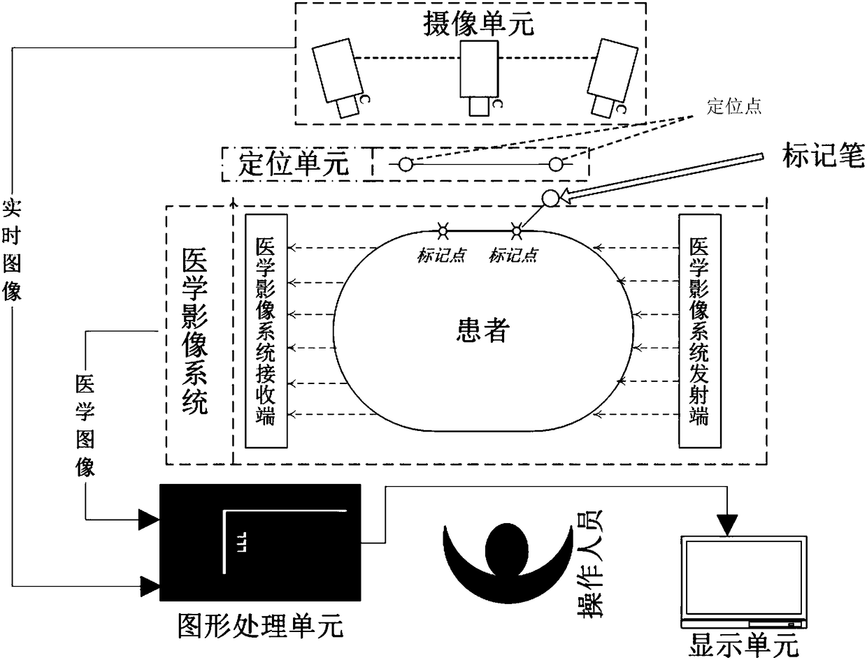 Body surface marking method and device with real-time image guidance