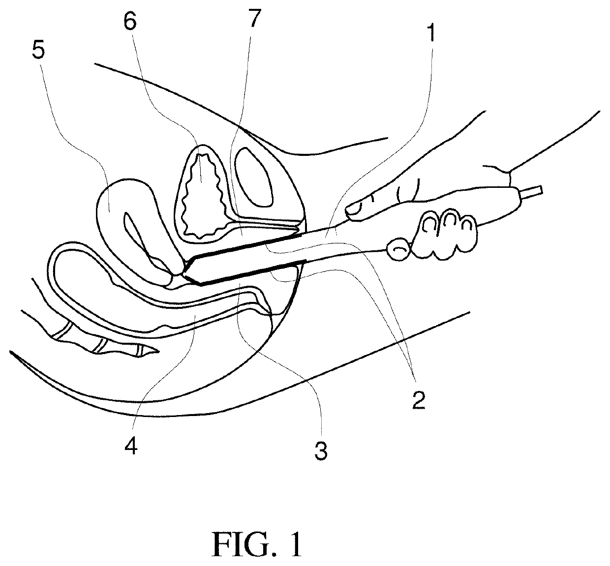 Methods for biomechanical mapping of the female pelvic floor