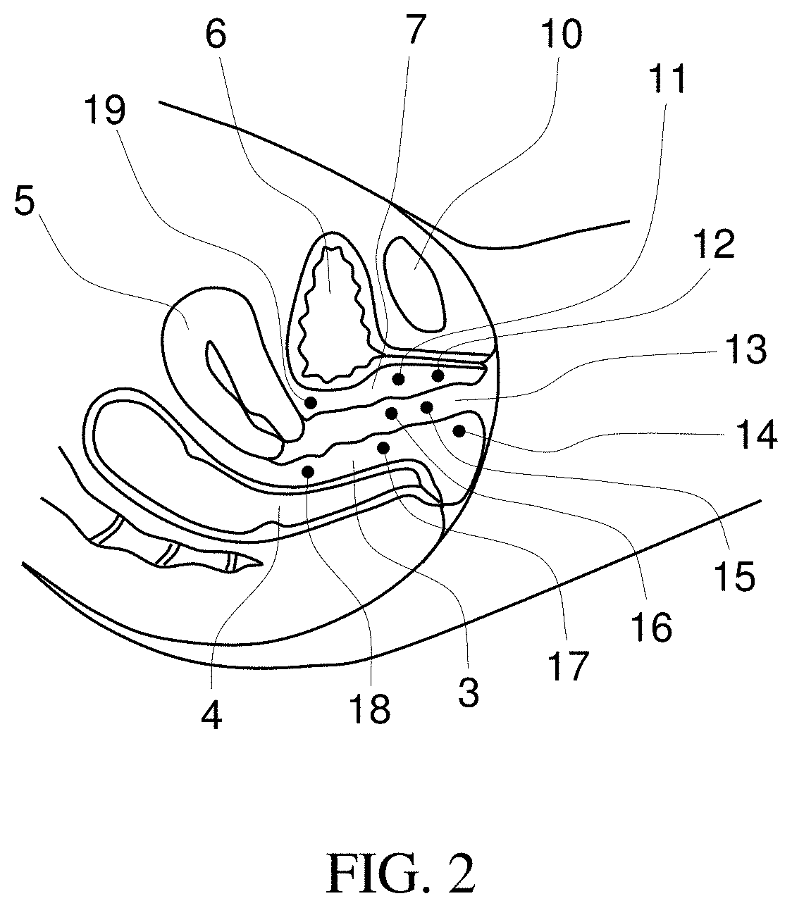 Methods for biomechanical mapping of the female pelvic floor