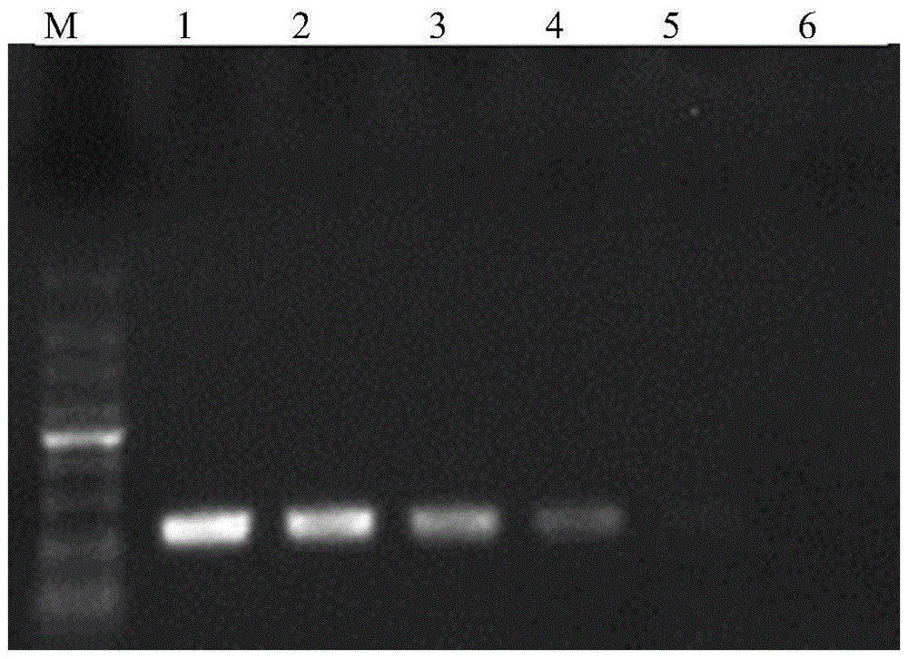 Lyme disease spirochaete detection RPA primer and probe and detection method thereof