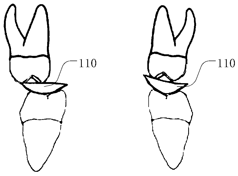 Tooth bite force measuring device and oral wearing device