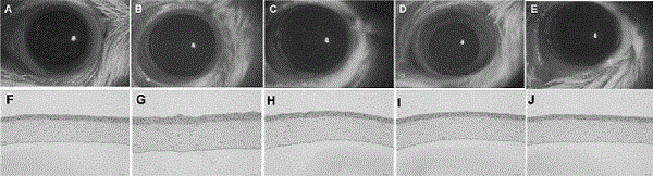 Application of novel eye drops in treatment of dry eyes