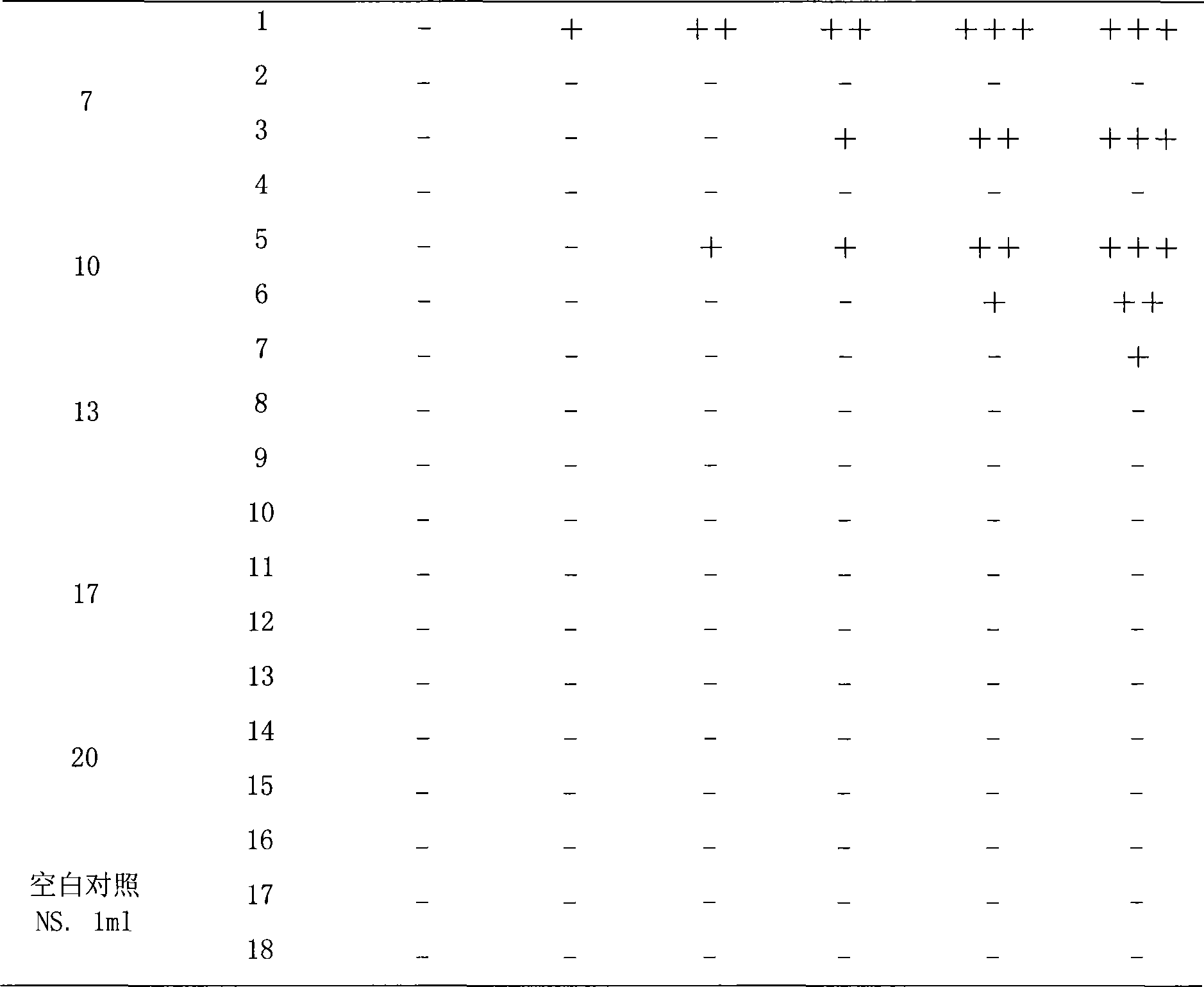 Notoginsenoside pharmaceutical composition and method for preparing the same and use thereof