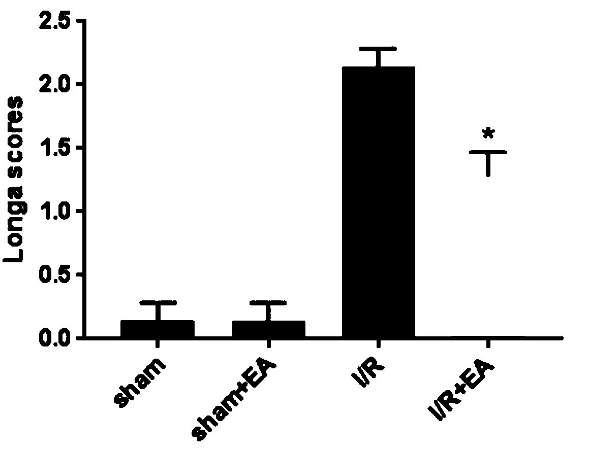 Application of echinocystic acid in preparation of drugs for treating cerebral infarction