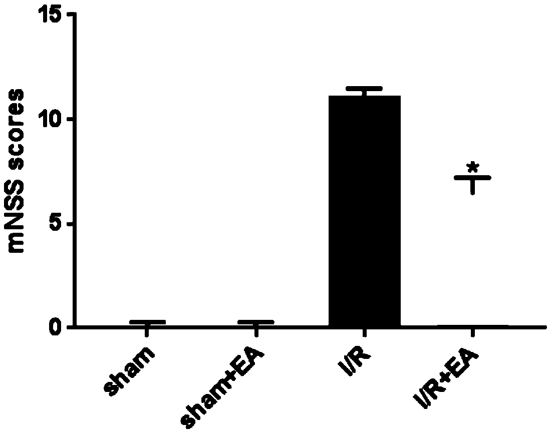 Application of echinocystic acid in preparation of drugs for treating cerebral infarction