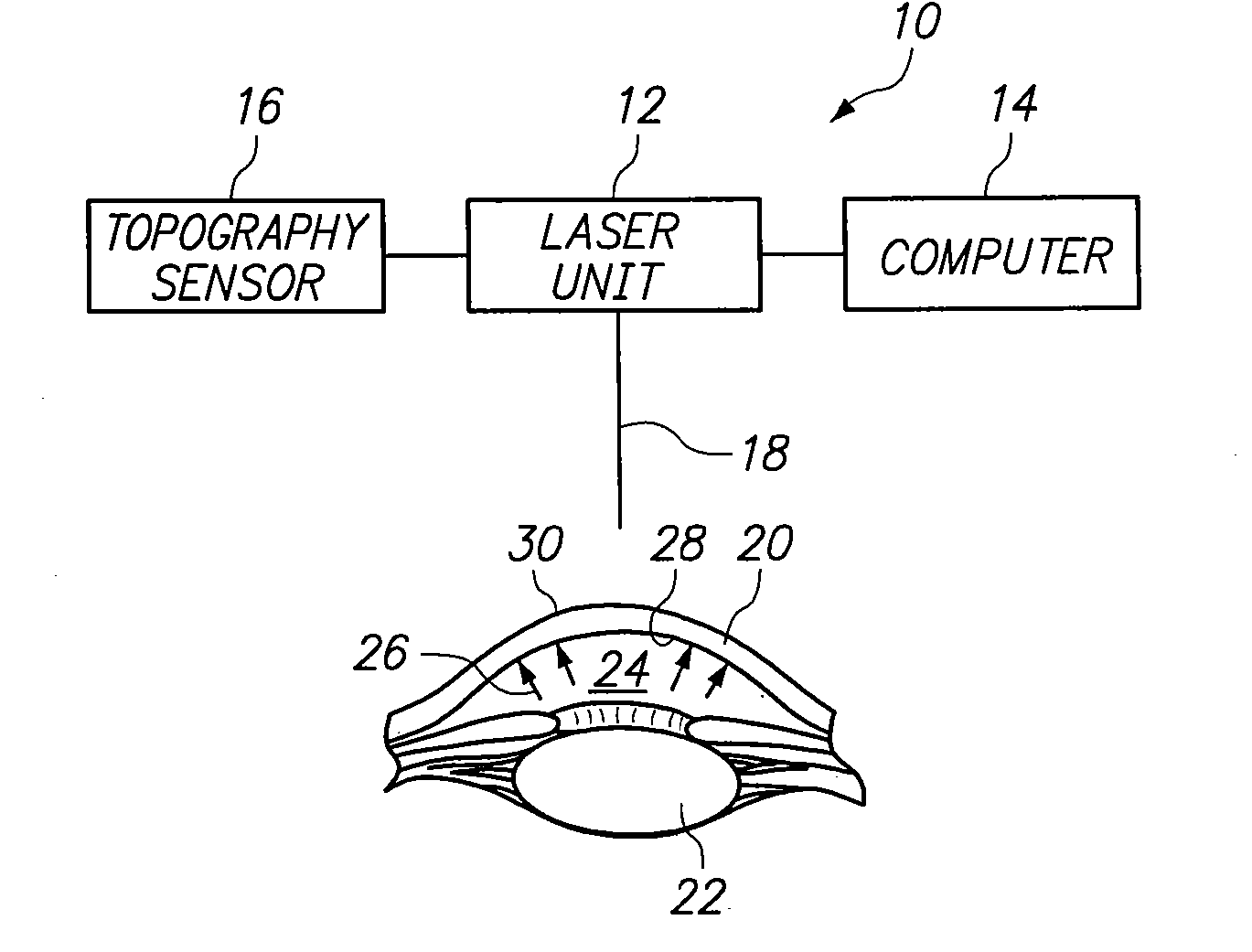 System and method for altering internal stress distributions to reshape a material