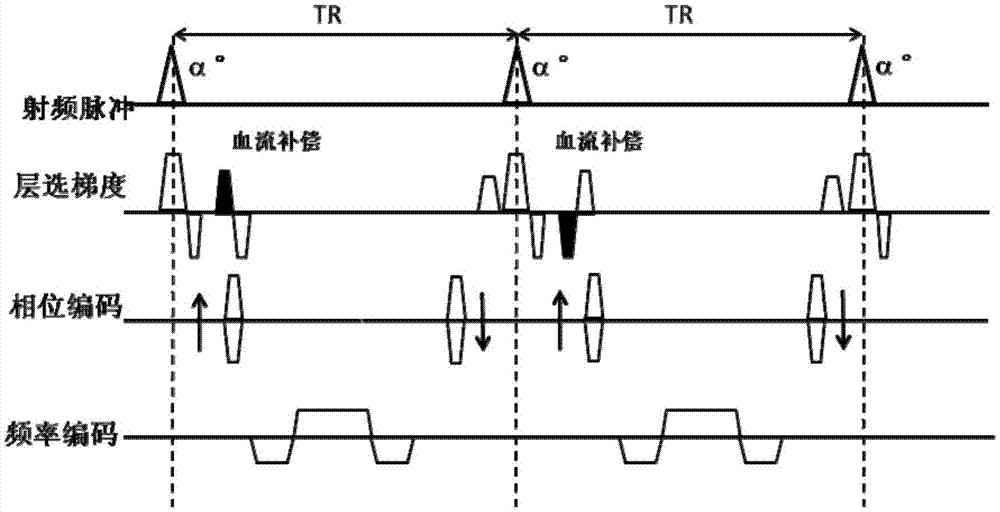 Measurement method and device for cardiac blood flow speed of magnetic resonance