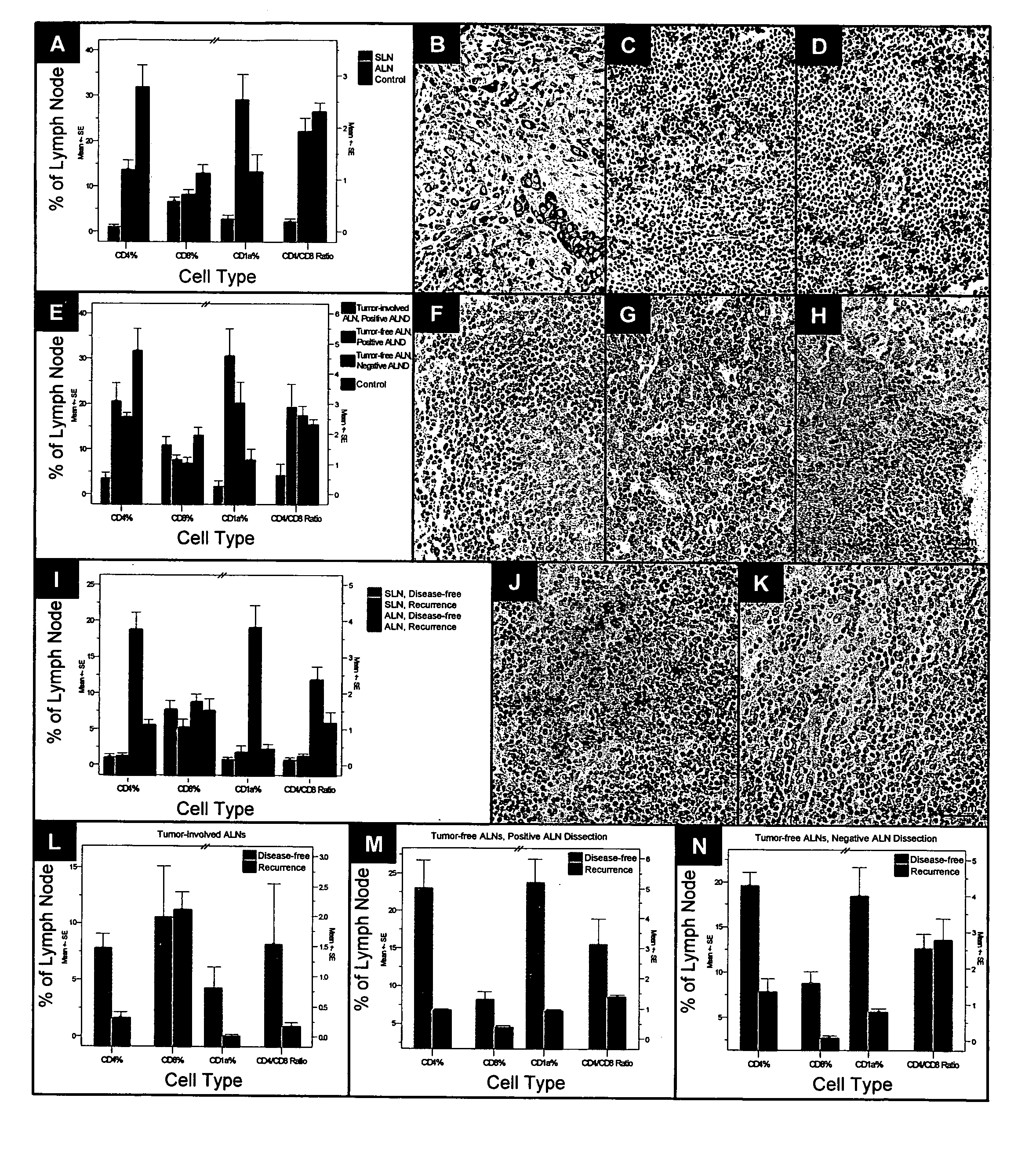 Immune profiling of lymph nodes associated with cancer