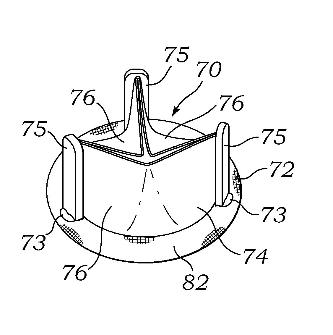 Surgical heart valves adapted for post-implant expansion