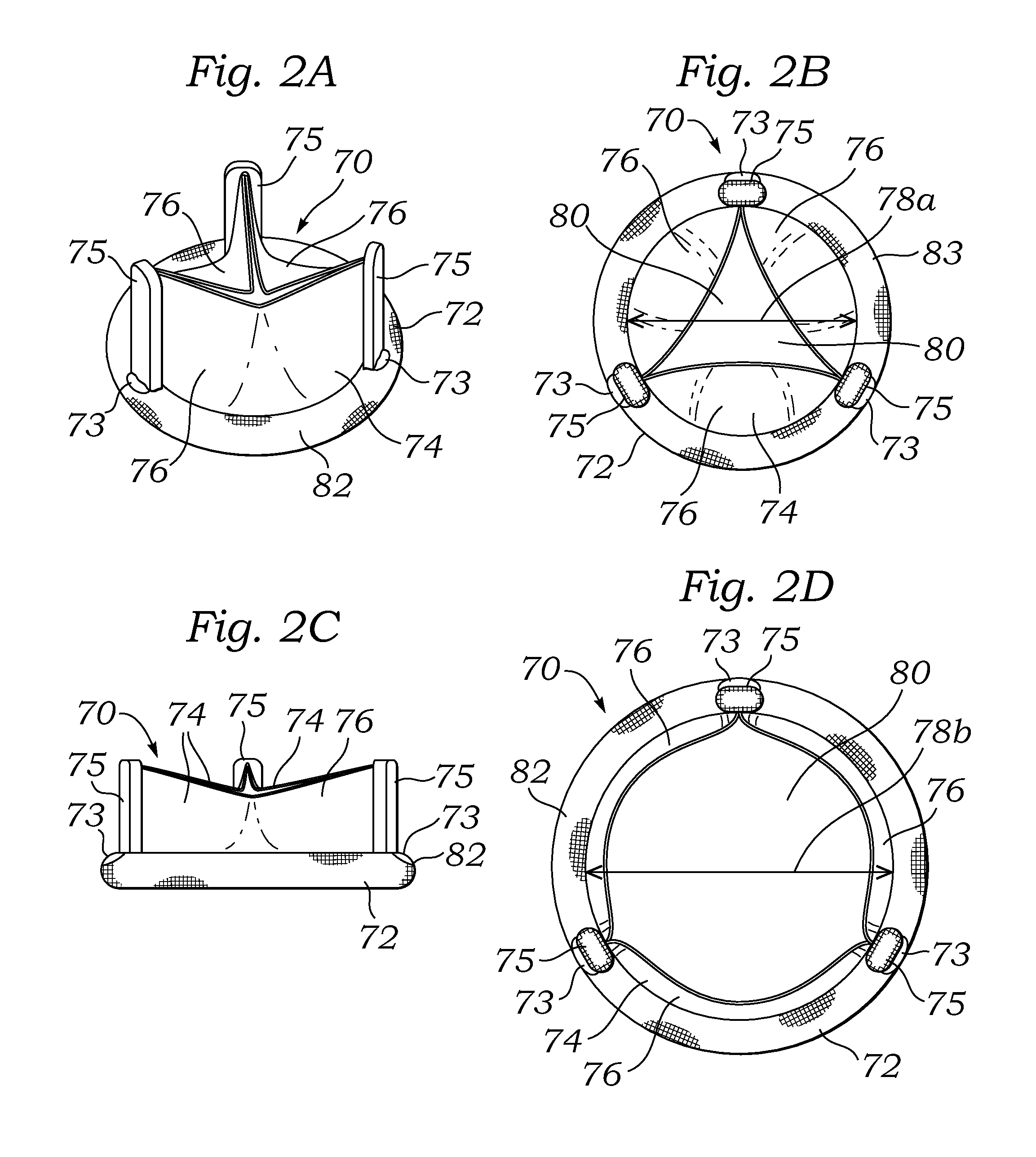 Surgical heart valves adapted for post-implant expansion