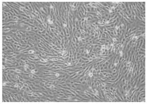 Porcine circovirus type 3 strain, and preparation method and application thereof