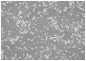 Porcine circovirus type 3 strain, and preparation method and application thereof