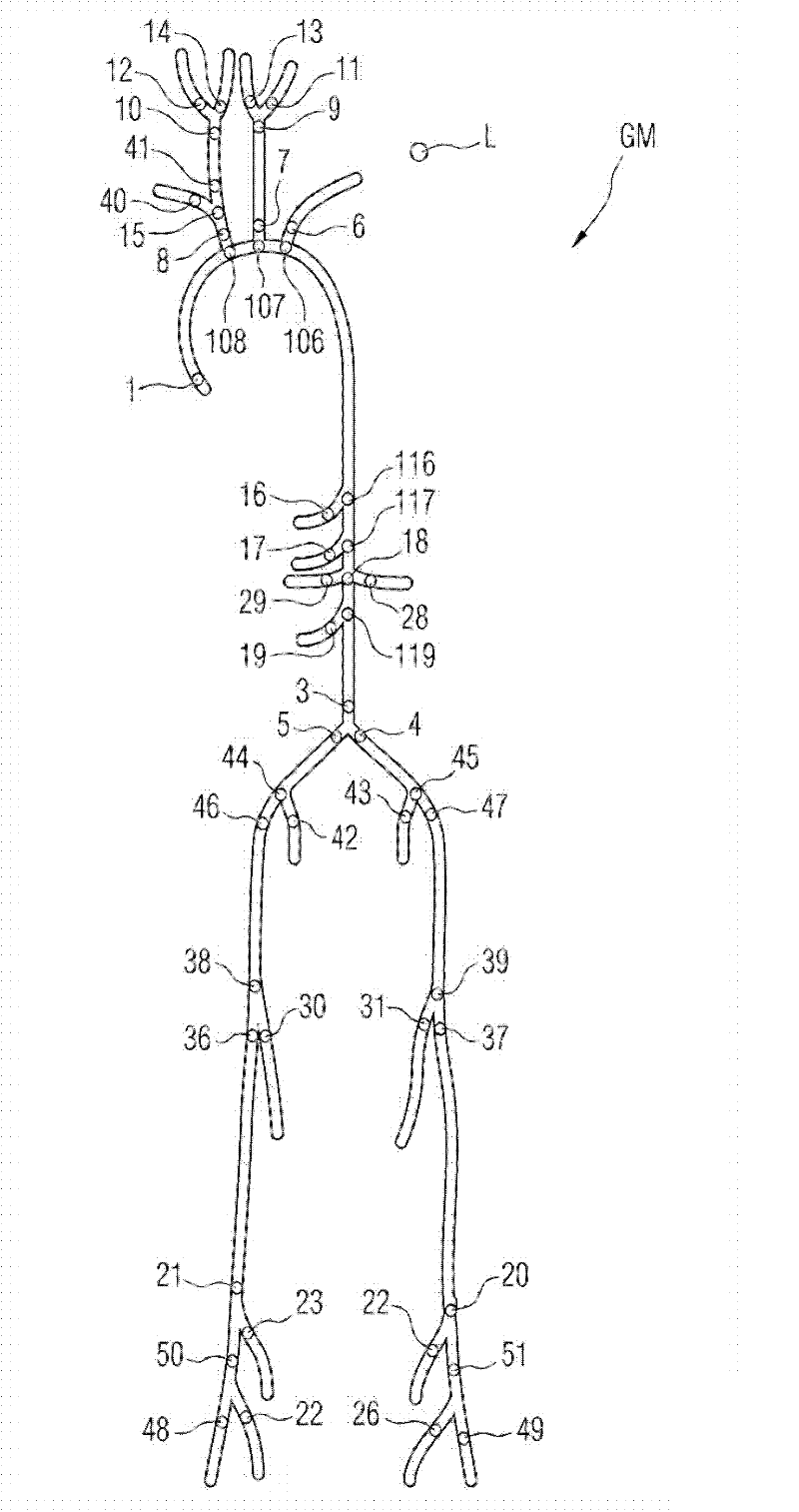 Method and computer system for automatic vectorization of a vessel tree