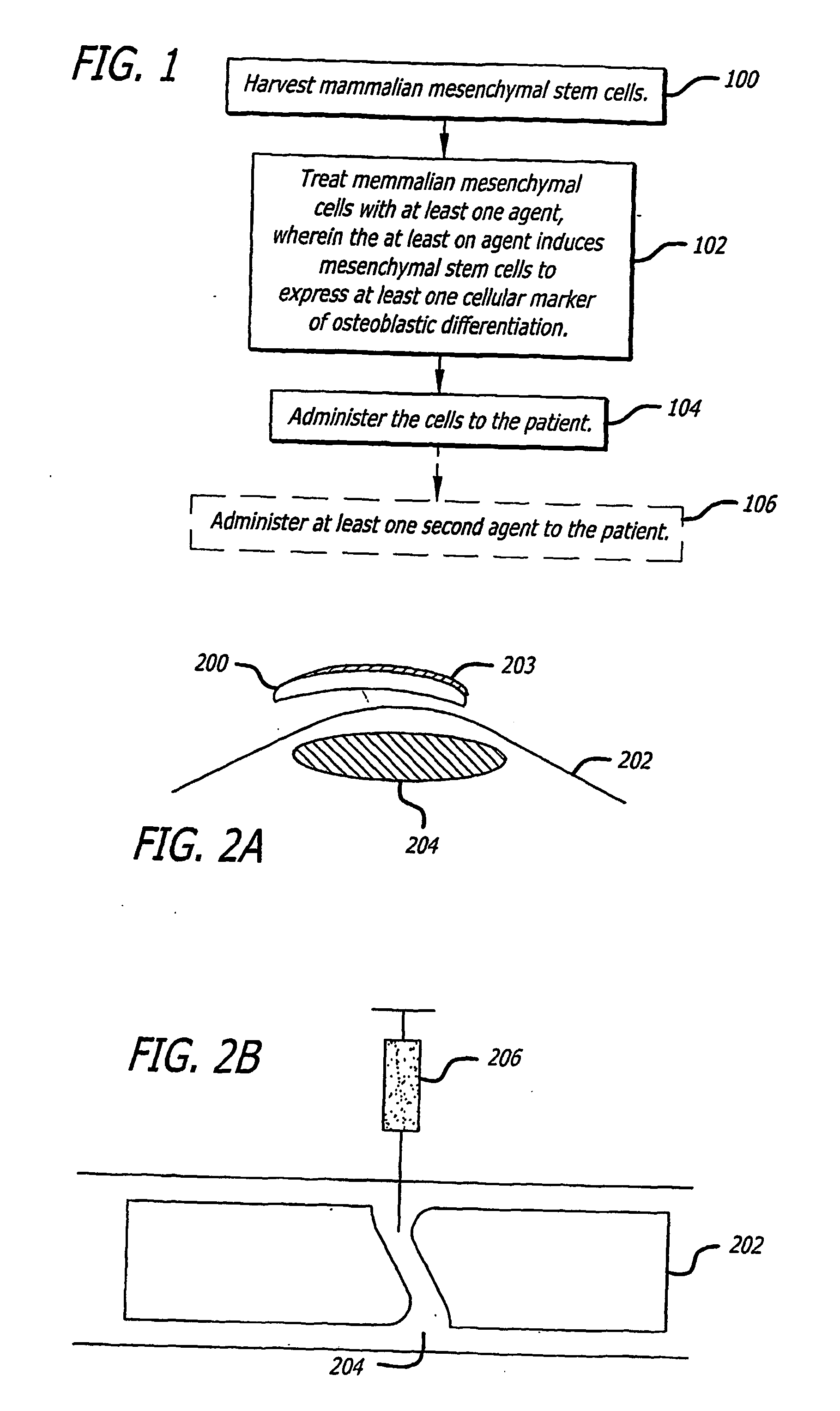 Agents and methods for enhancing bone formation