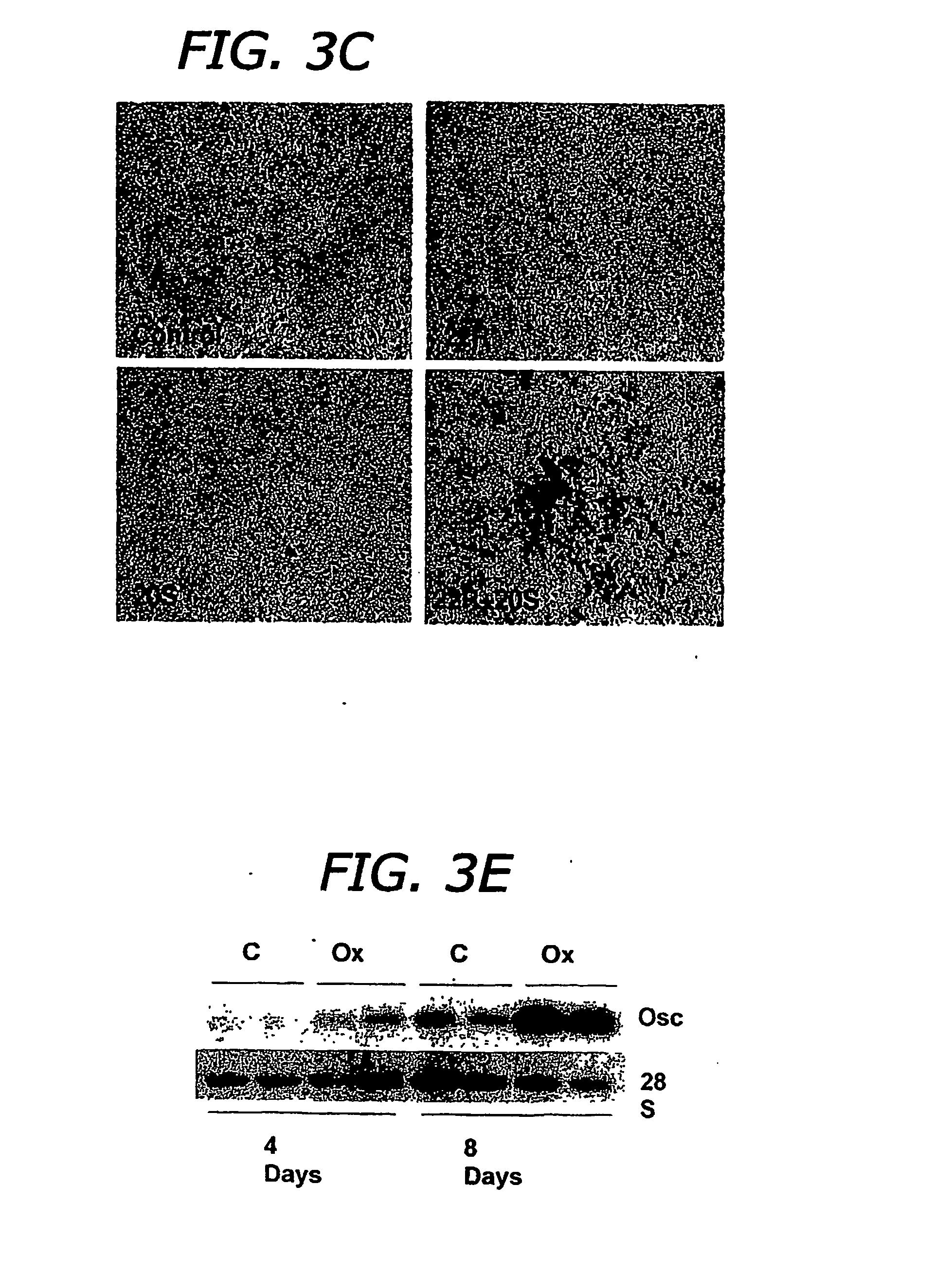 Agents and methods for enhancing bone formation