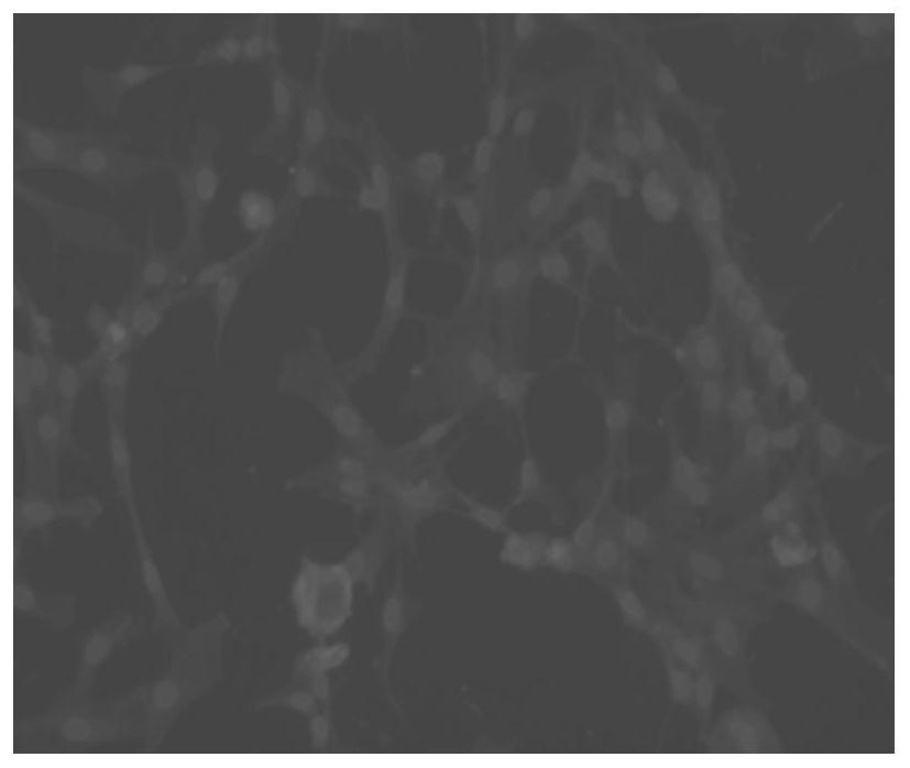 A primary isolation and culture method of naked mole rat bone marrow mesenchymal stem cells