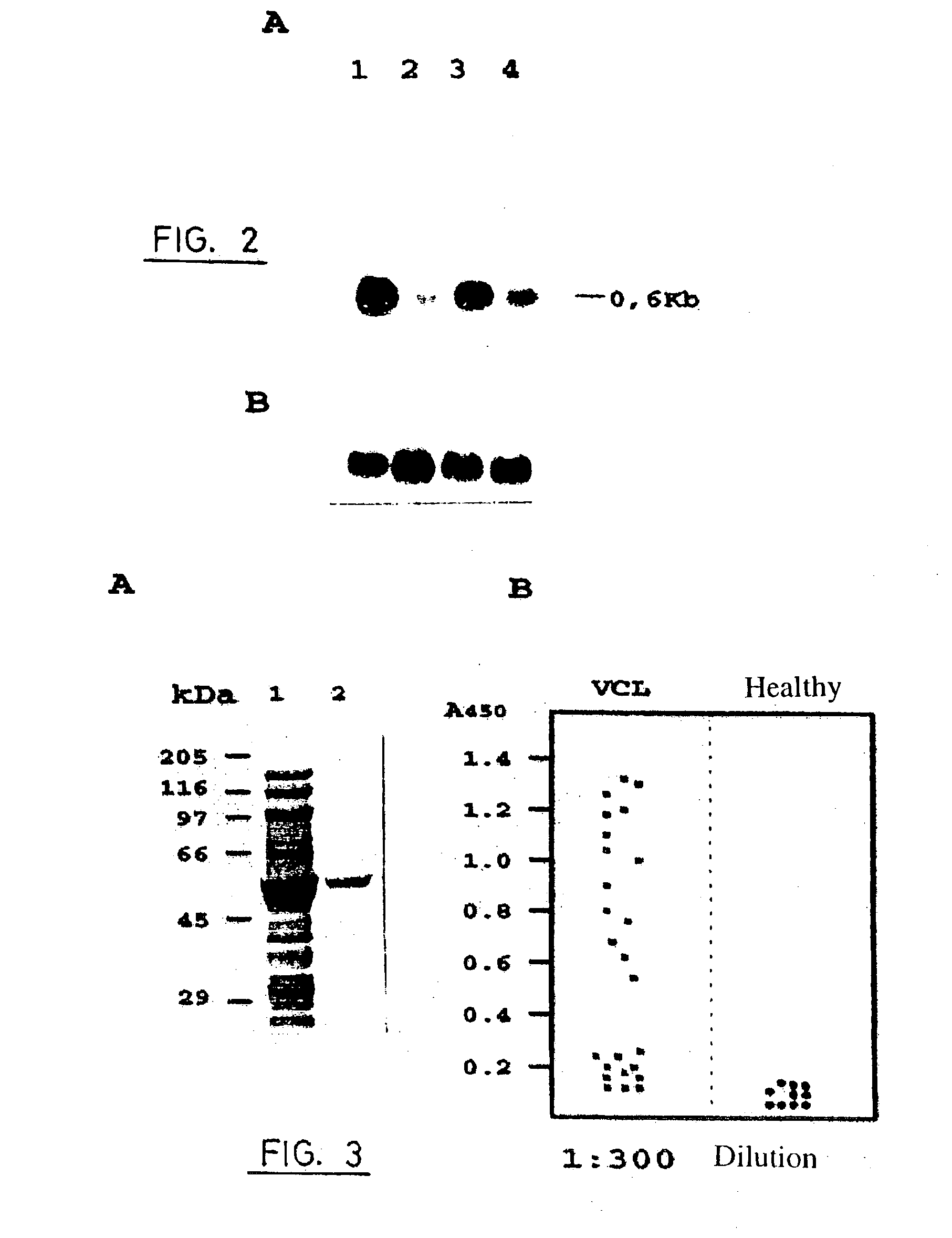 Composition containing leishmania lip2a