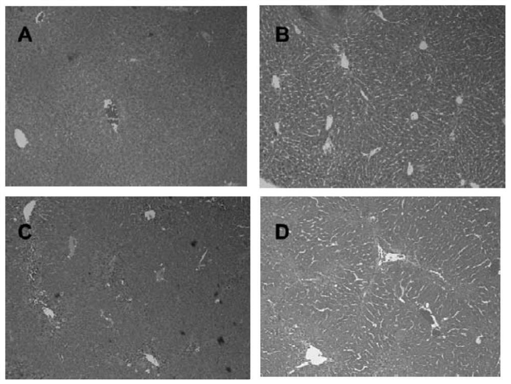 low molecular weight heparin