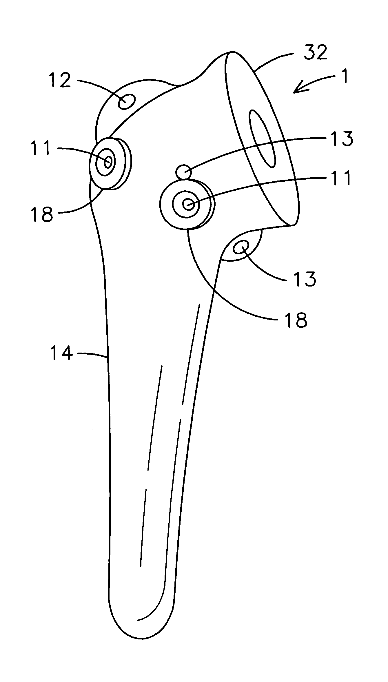 Prosthetic humeral device and method